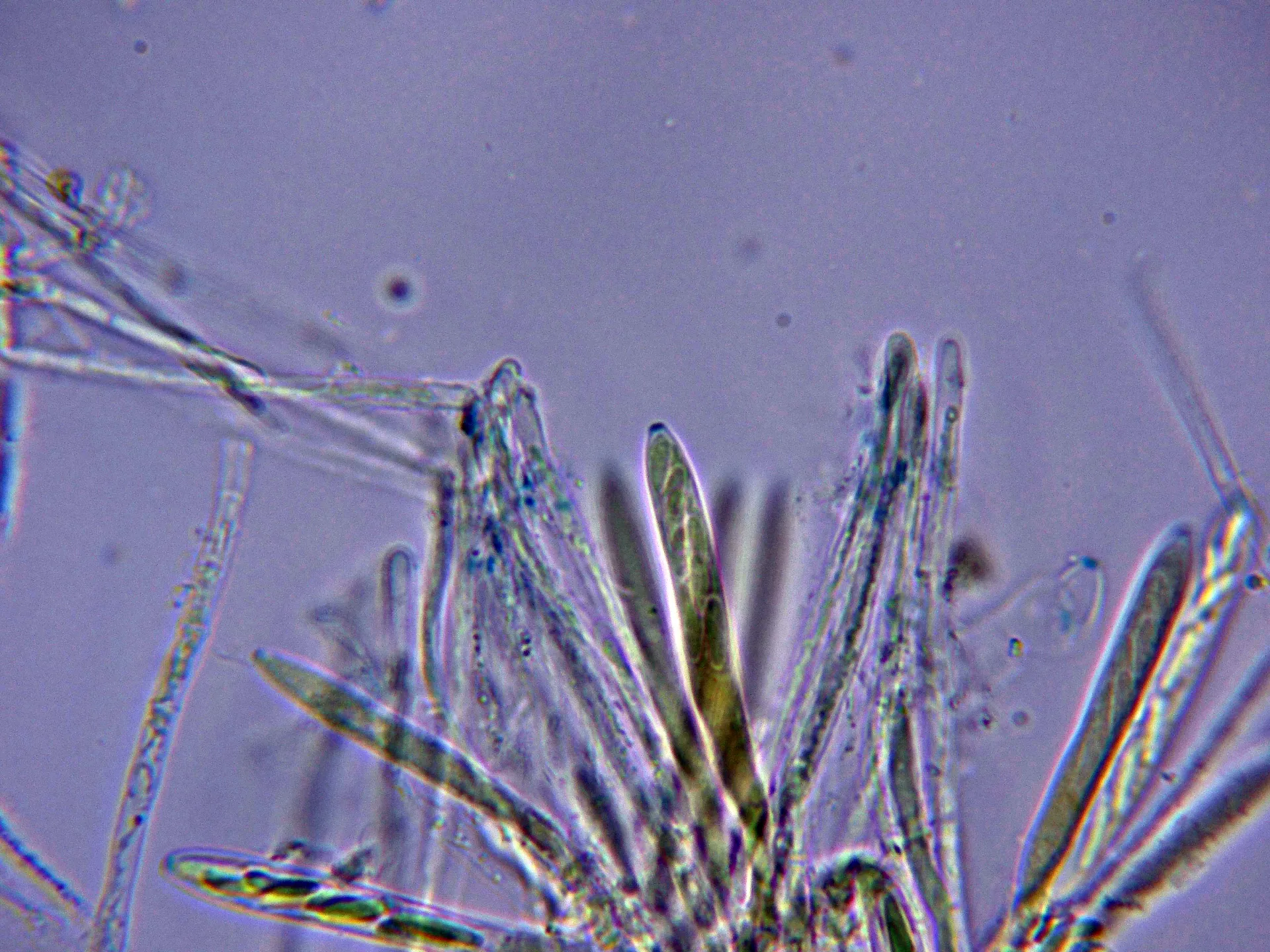 Microscopía de Mollisia ponticulorum - 10 - Ascos Melzer-003